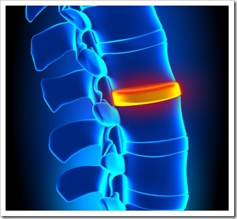 Herniated Disc and Back Pain Quincy MA