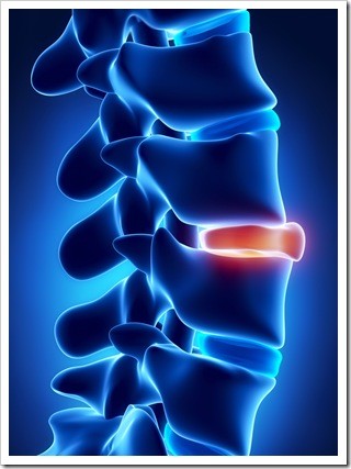 Slipped Disc Quincy MA